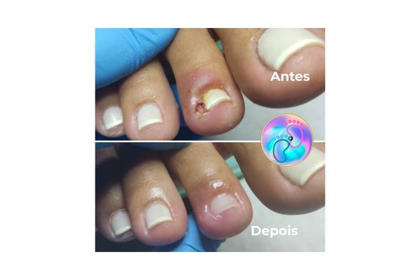 Foto de antes e depois do tratamento 34